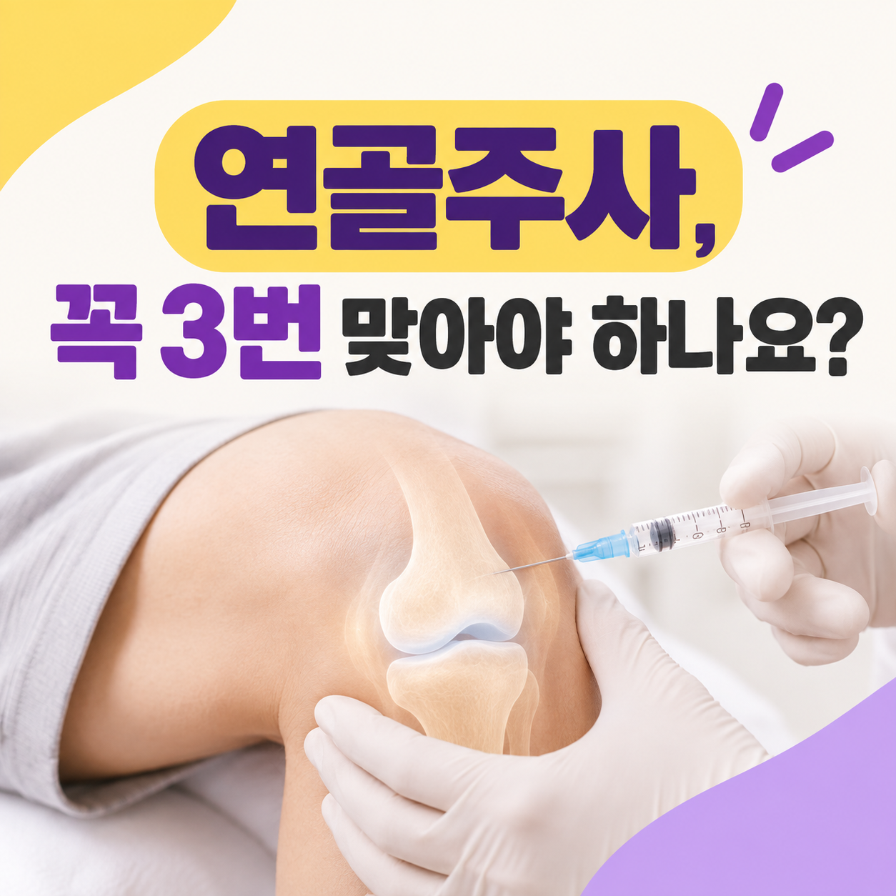 연골주사, 꼭 3번 맞아야 하나요? | 까치산역 무릎 연골주사